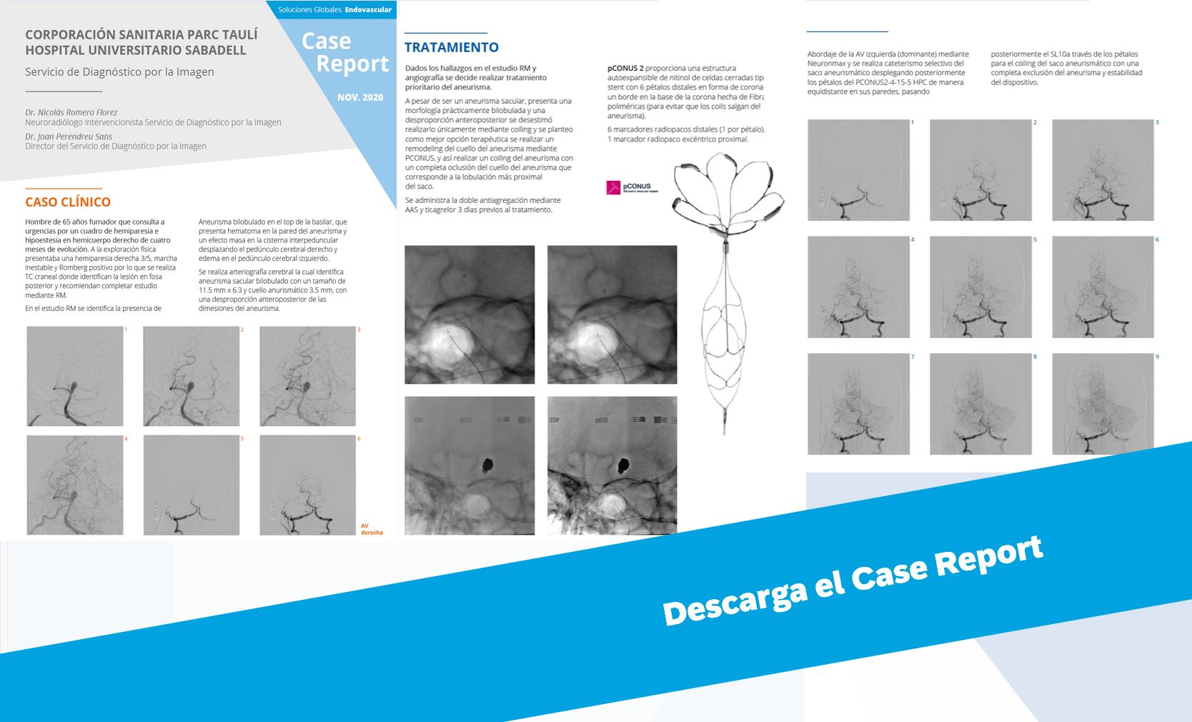 case-report-diagnostico-hospital-sabadell